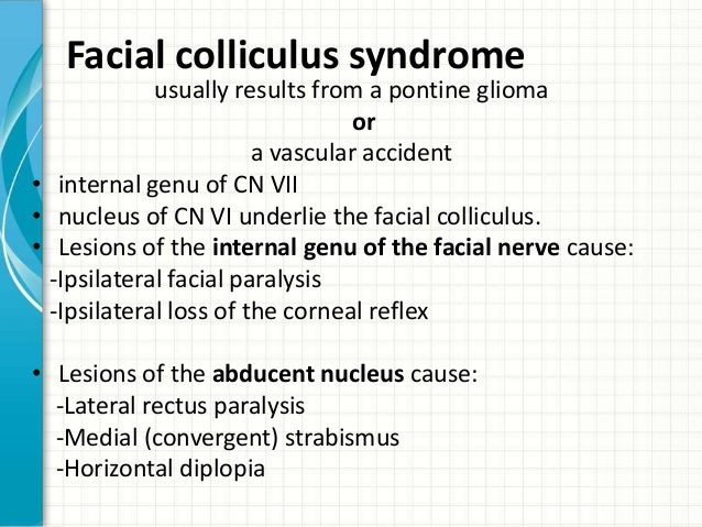 Facial colliculus syndrome picture 821